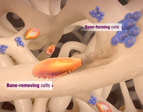 TYMLOS adds to the bone through a 2-step, dual-action process