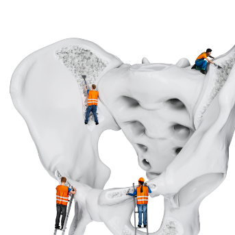 Construction workers repairing bone marrow of the hip